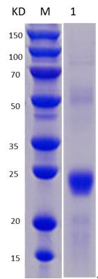 12% SDS-PAGE analysis profiles of purified NTHI1229-30-216 (CBB stained).